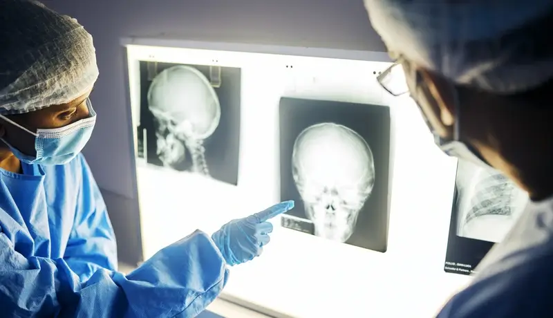 Δύο γιατροί με προστατευτικές στολές εξετάζουν ακτινογραφίες κεφαλιού σε φωτιζόμενο πίνακα.