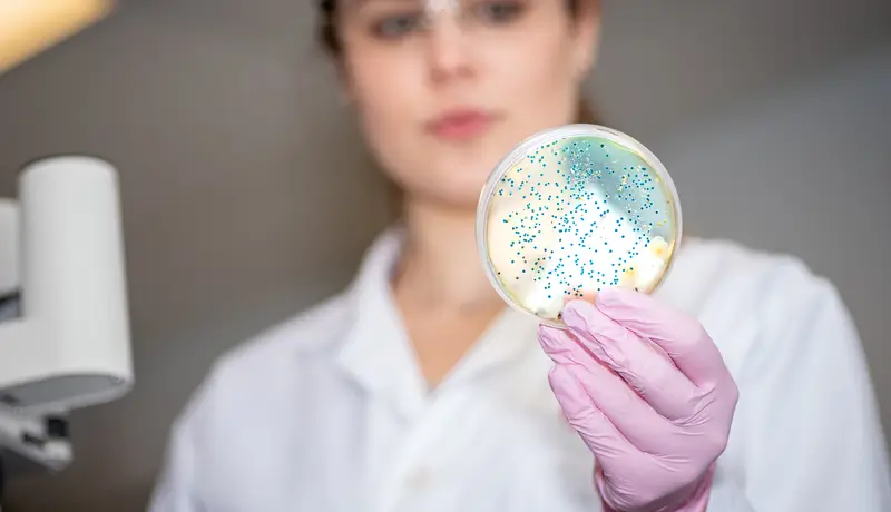 Γυναίκα επιστήμονας σε εργαστήριο κρατώντας πλάκα Petri με βακτήρια σε μικροσκοπική ανάλυση.
