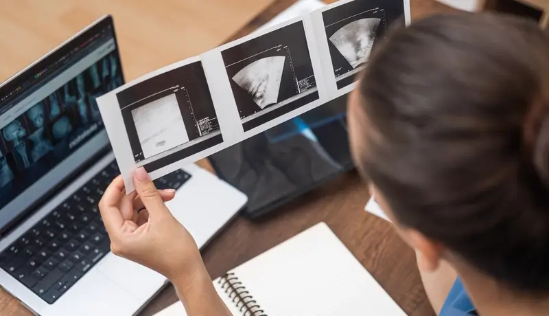 Επαγγελματίας υγείας εξετάζει εκτυπωμένες εικόνες υπερηχοτομογραφίας σε γραφείο, με φορητό υπολογιστή και σημειωματάριο στο φόντο.