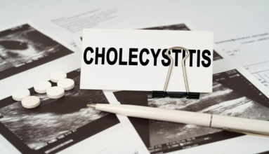 Homed-Acute Cholecystitis: A Case Study