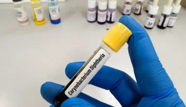 Homed-Διφθερίτιδα