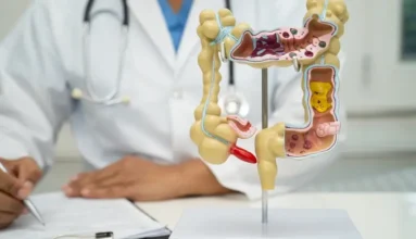 Homed-Gastroenteritis