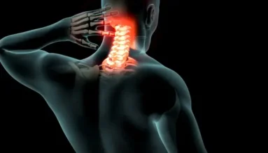 Homed-Αυχεναλγία: Πρόληψη, Αντιμετώπιση και Εργονομικές Συμβουλές για Καθημερινή Ανακούφιση