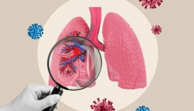 Homed-Πνευμονία