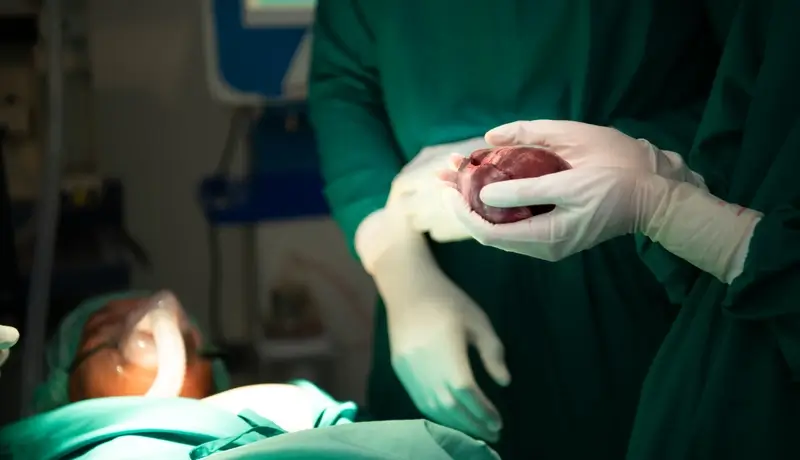 Homed-Biological Heart Patch Treatment: A Breakthrough for Heart Failure