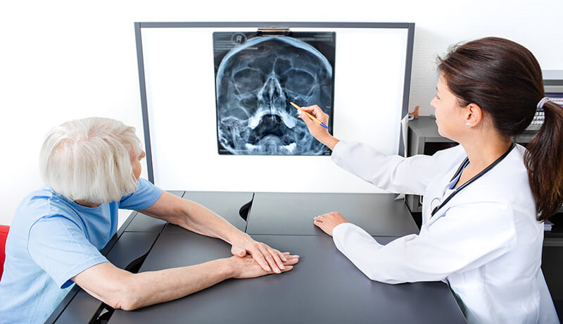 Διαχείριση της Ιγμορίτιδας με αναφορά σε ακτινογραφία παραρρίνιων κόλπων.