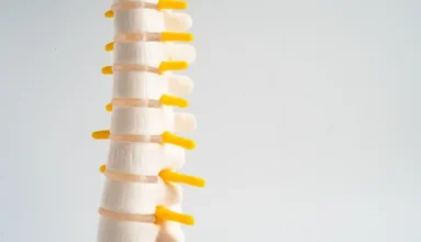 Homed-Ankylosing Spondylitis