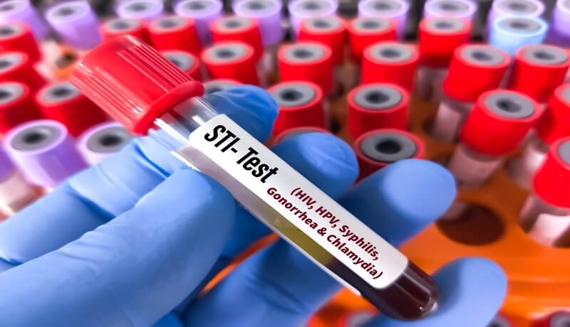 Homed-Sexually Transmitted Infections