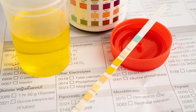 Homed-Ουρία στο αίμα: Φυσιολογικά όρια και τι δείχνει η εξέταση